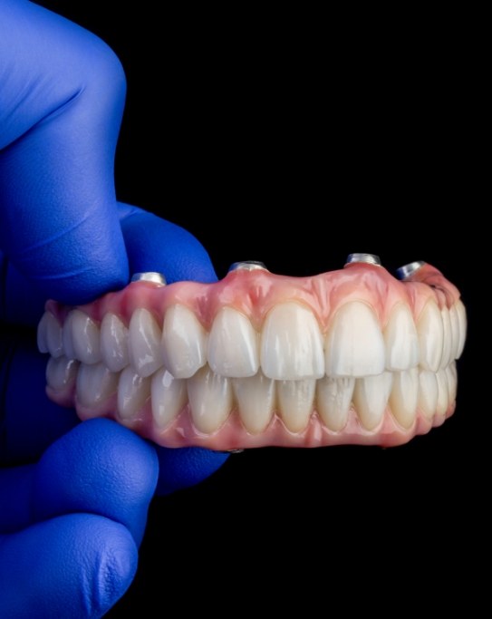 Gloved hand holding a set of implant dentures