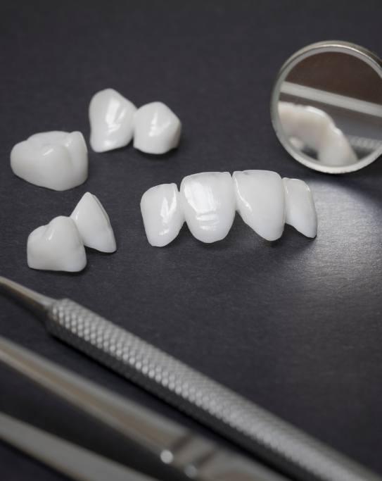 Several white dental crowns and veneers next to dental mirrors