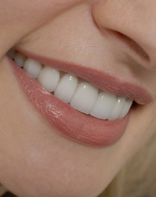 Close up of woman smiling with flawless teeth