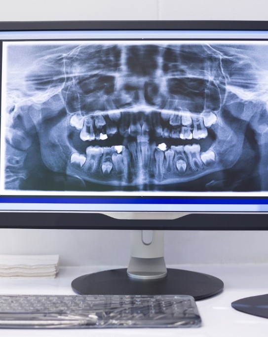 Computer screen showing digital panoramic x rays of teeth
