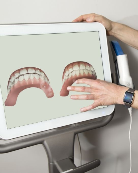 Dentist pointing to digital impressions of teeth on monitor
