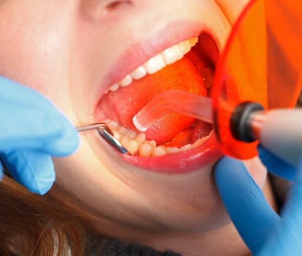 Dental patient getting tooth treated with direct bonding in New York