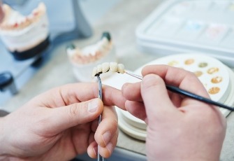 Ceramist crafting a dental bridge