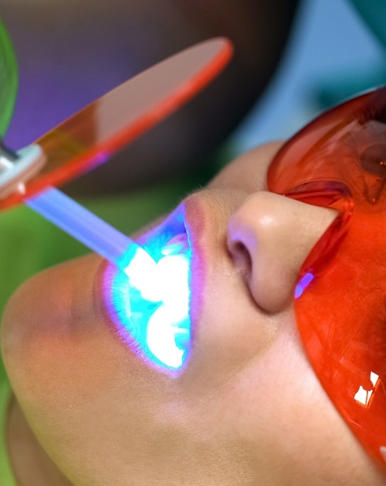 Close up of dental patient getting professional teeth whitening