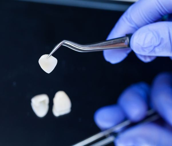 Several all ceramic dental crowns and veneers on table next to dental mirrors