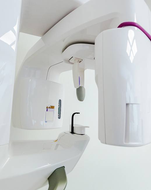 CBCT machine in dental office