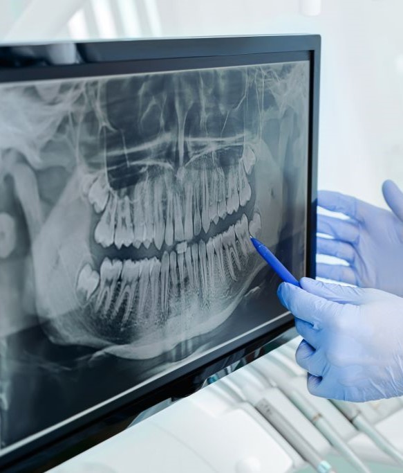 Dentist pointing to digital x rays of teeth on computer screen