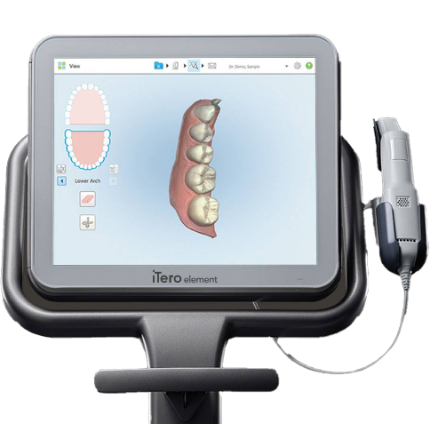 Computer monitor showing digital impressions of teeth