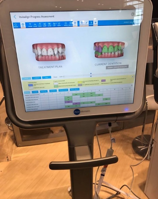 Monitor with digital impressions of teeth from iTero scanner in New York
