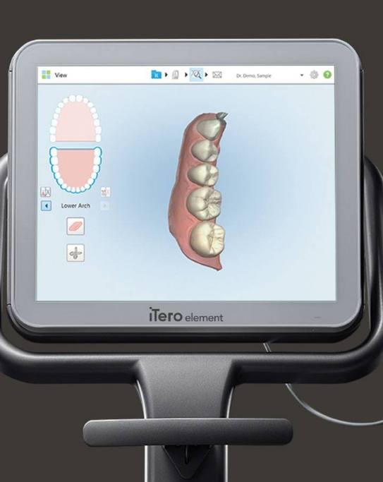 Digital model of row of teeth on computer screen