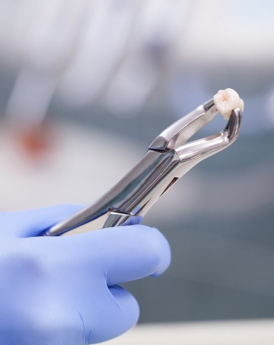 Dentist holding an extracted tooth in foreceps