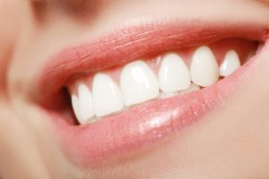 Women’s teeth with veneers